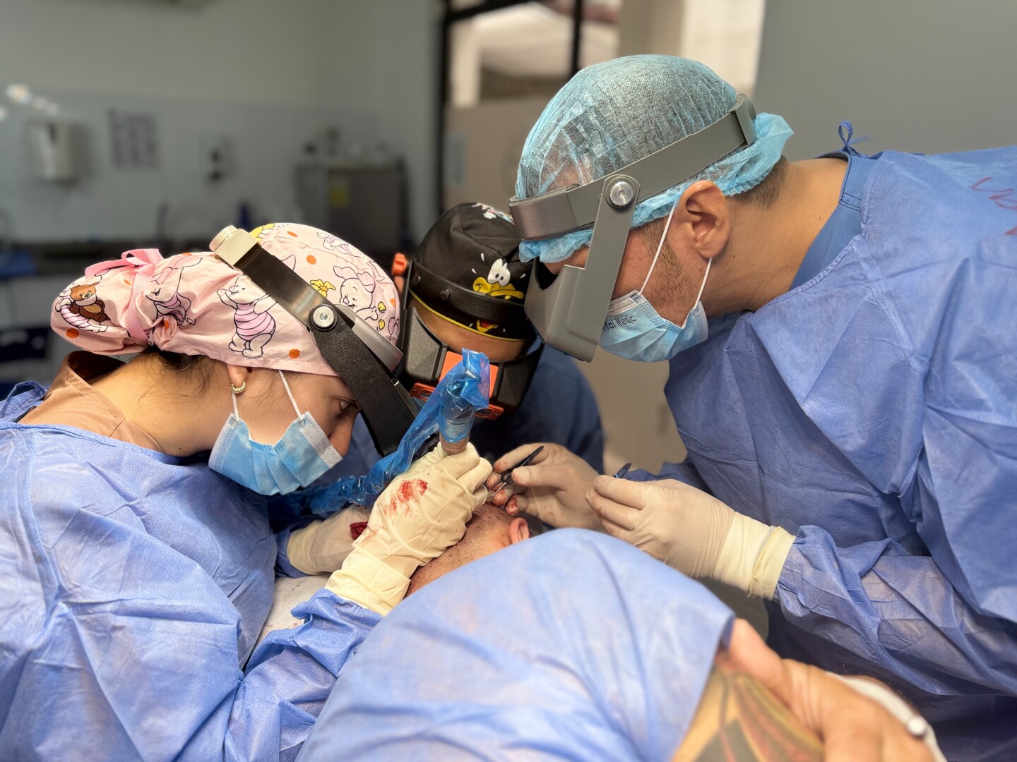 Curso Universitario de Microimplante Capilar
